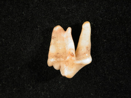 Tooth