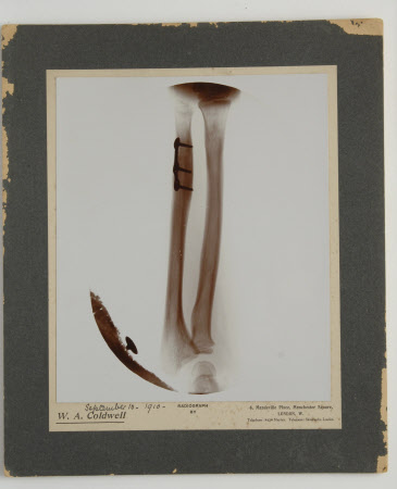 Radiograph, mounted, photograph of Henry John Ralph Bankes (1902-1981) right forearm, by W. A. ...