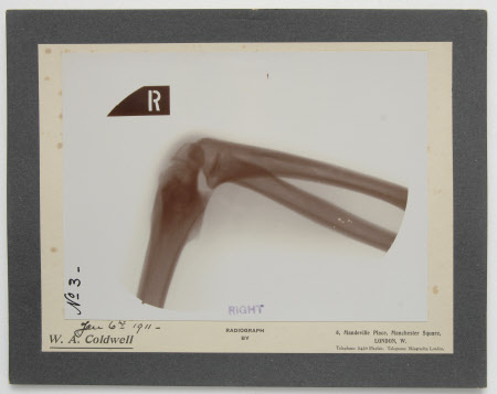 Radiograph