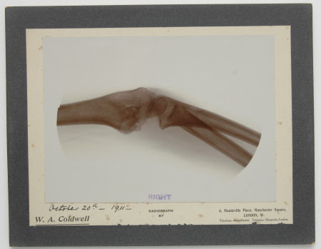 Radiograph