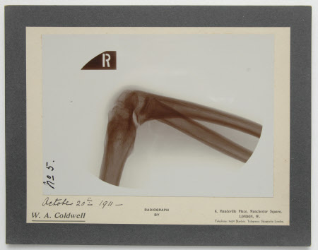 Radiograph