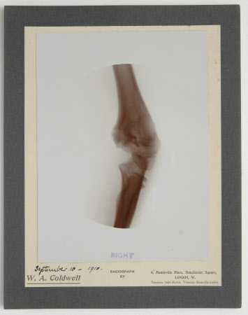 Radiograph