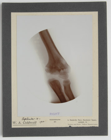 Radiograph