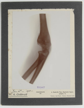 Radiograph