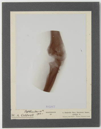Radiograph