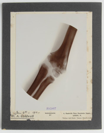 Radiograph