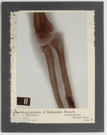 Radiograph