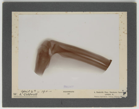 Radiograph