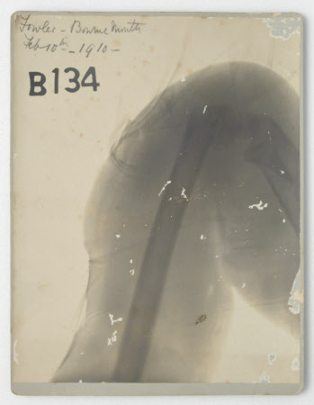 Radiograph