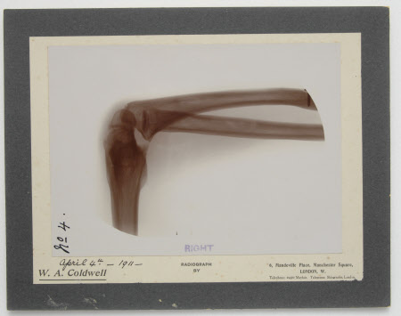 Radiograph
