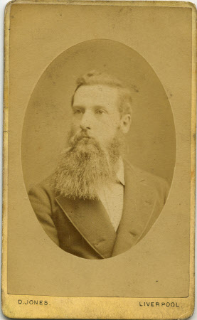 Burns