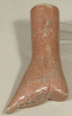 Bound foot