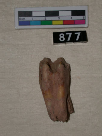 Tooth
